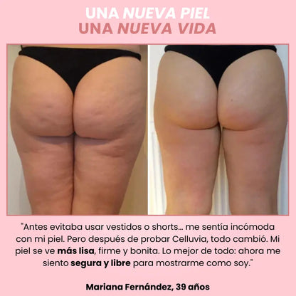 Celuvia™ Masajeador Anticelulítico + 2 Aceites Celuvia GRATIS