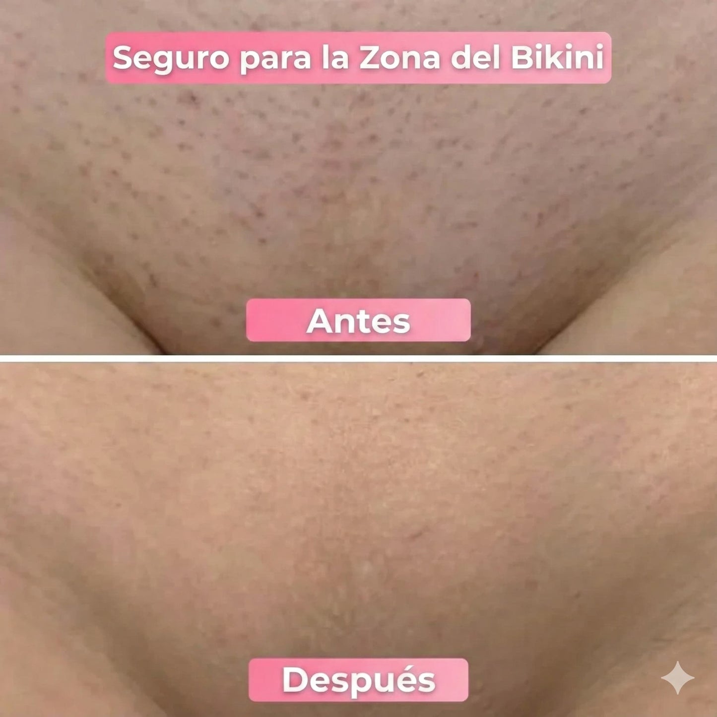 Lissia  – Depiladora 2 en 1 para Todo el Cuerpo