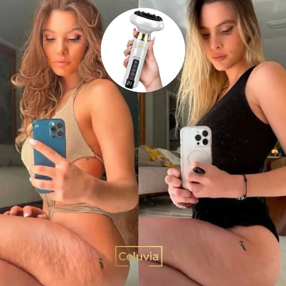 Celuvia™ Masajeador Anticelulítico + 2 Aceites Celuvia GRATIS